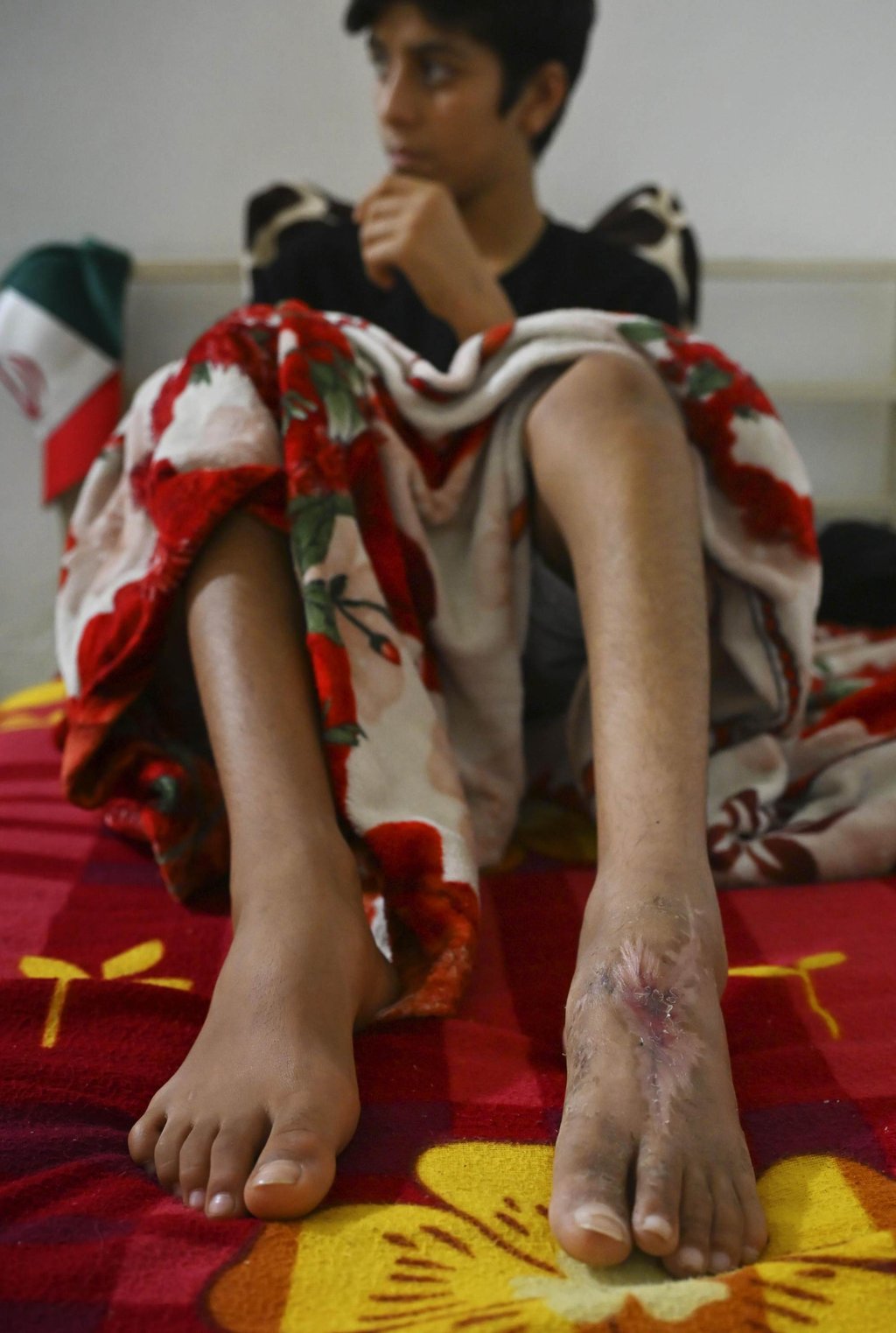 Mohammad Reza Barfar, who suffered severe lacerations to his left leg. Photo: Kyodo Mohammad Reza Barfar, who suffered severe lacerations to his left leg. Photo: Kyodo